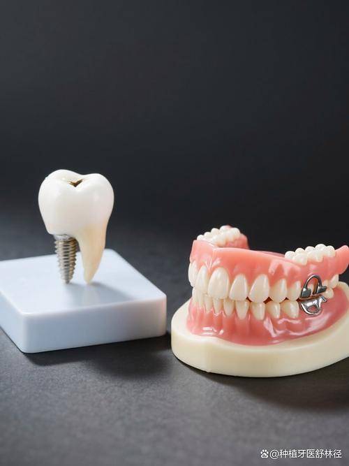 种植牙和活动假牙到底怎么选？看看你的情况适合哪一种!