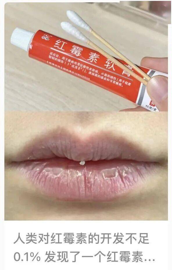这种药膏千万别再随便用了！很多人家中常备......