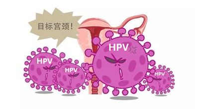 男性HPV筛查：方法、现状与前行中的挑战