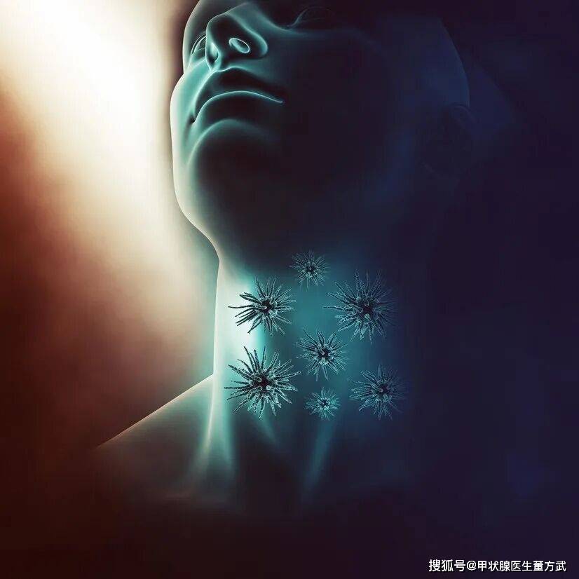 为什么桥本甲状腺炎患者易伴发结节？