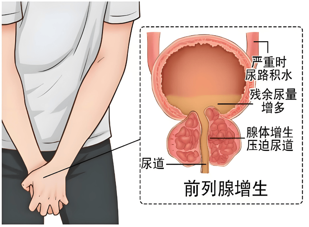 @爷叔们 您一晚上起夜多少次？