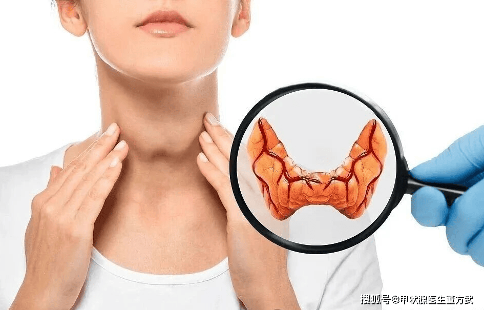 甲状腺疾病与老年心理健康