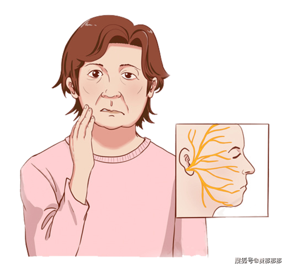 面肌痉挛做射频会有哪些后遗症