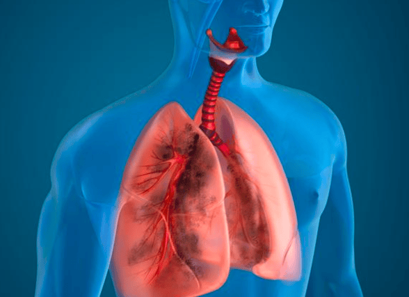 2025年收官：浙一思路 为晚期肺癌寡转移者创造生命奇迹