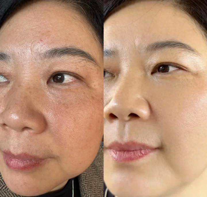 焕白抗衰护发别乱花钱！5年美容师教你4招，素颜紧致，秀发蓬松！