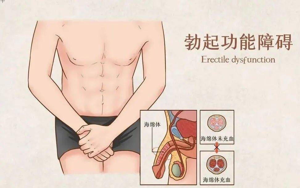 男性疾病的“隐蔽性”和“治疗难”！