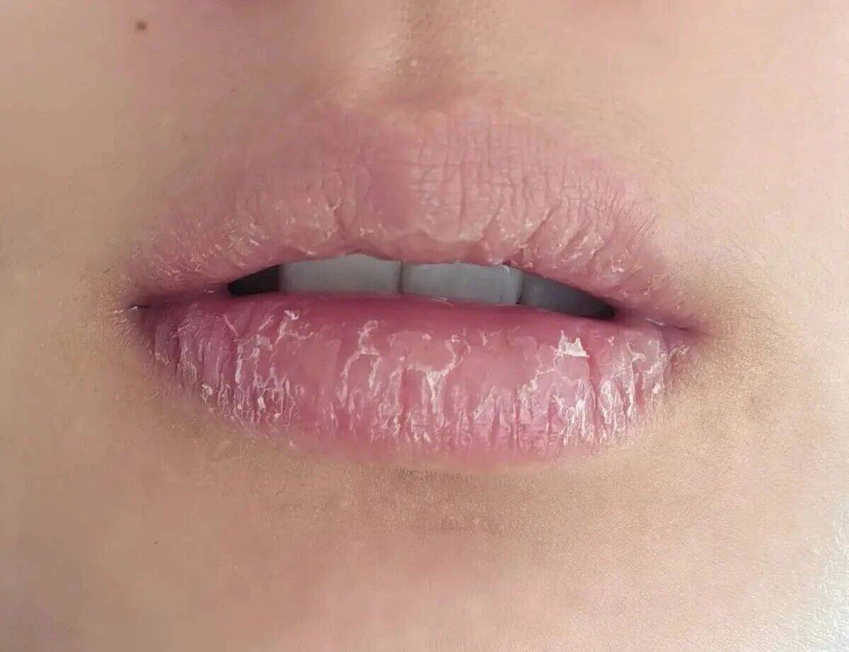 睡醒口干舌燥，是大病预警？提醒：经常这样可能与四个原因有关