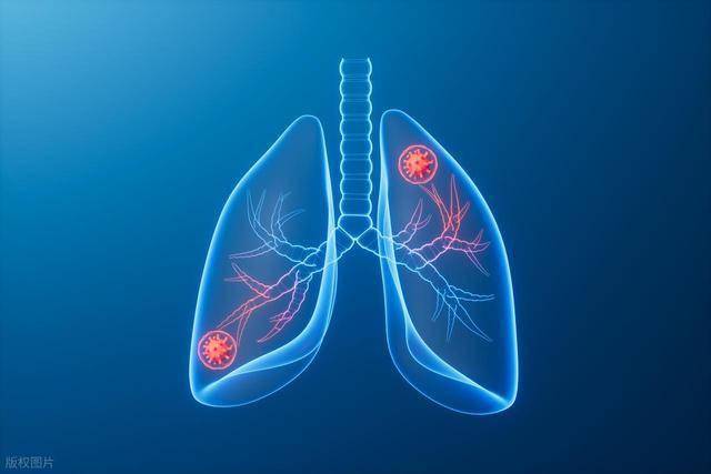 肺腺癌患者越来越多，再三提醒：家里的5样物品危害大，尽早扔掉