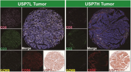 USP7：点燃MSS结直肠癌免疫治疗的“冷火”