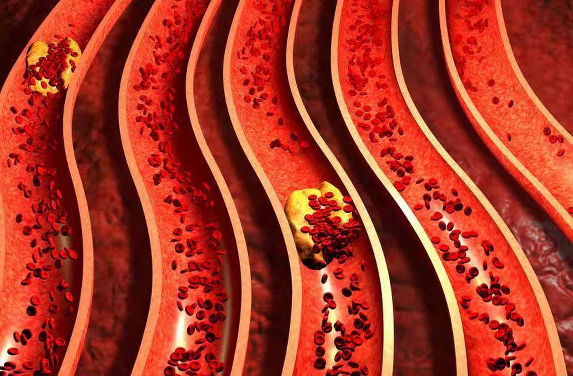 谁说三高脑梗中风偏瘫就不能吃肉？错！常吃五官鸡肉好处多着呢……