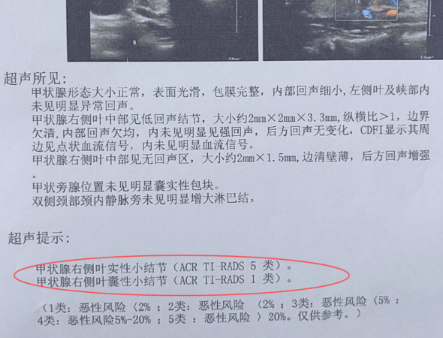医生最想告诉你的：甲状腺结节5类≠癌症！但这些事必须做