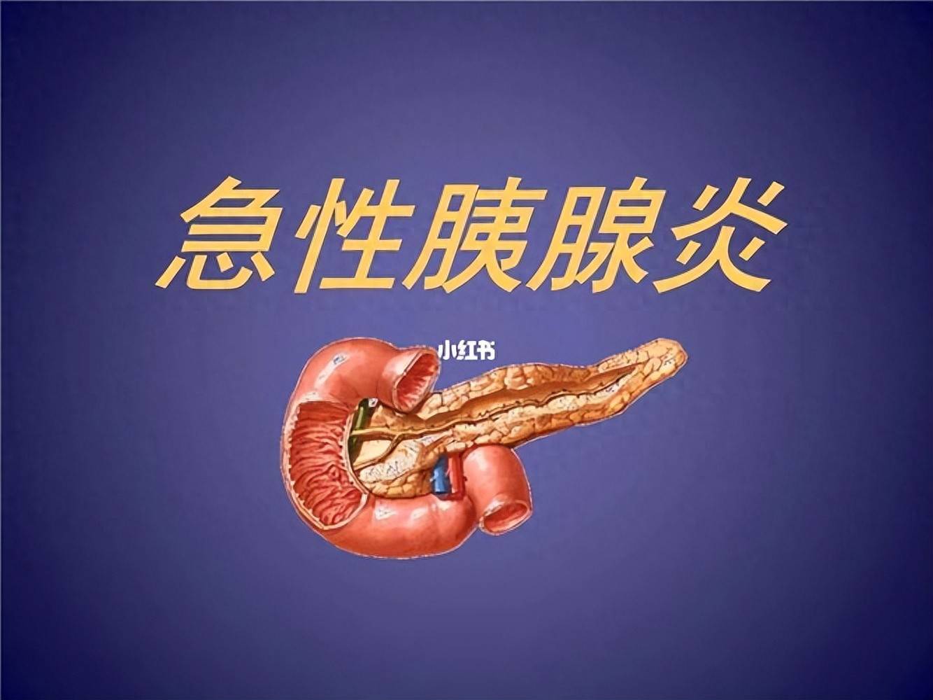 原创            持续性腹痛不是小事，小心急性胰腺炎，一旦出现6类症状及时就医