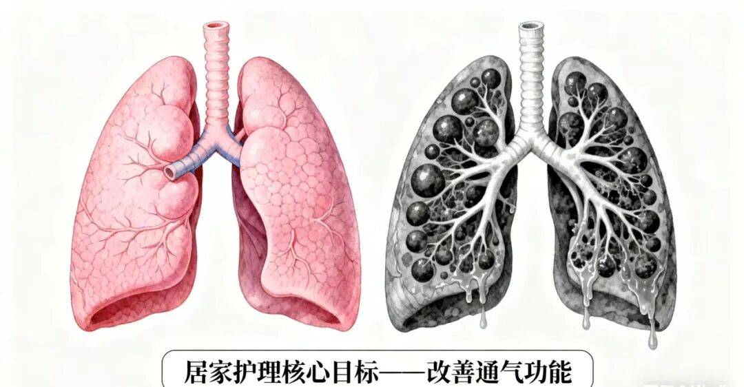 科普 | 让呼吸更轻松——慢阻肺日常护理全攻略
