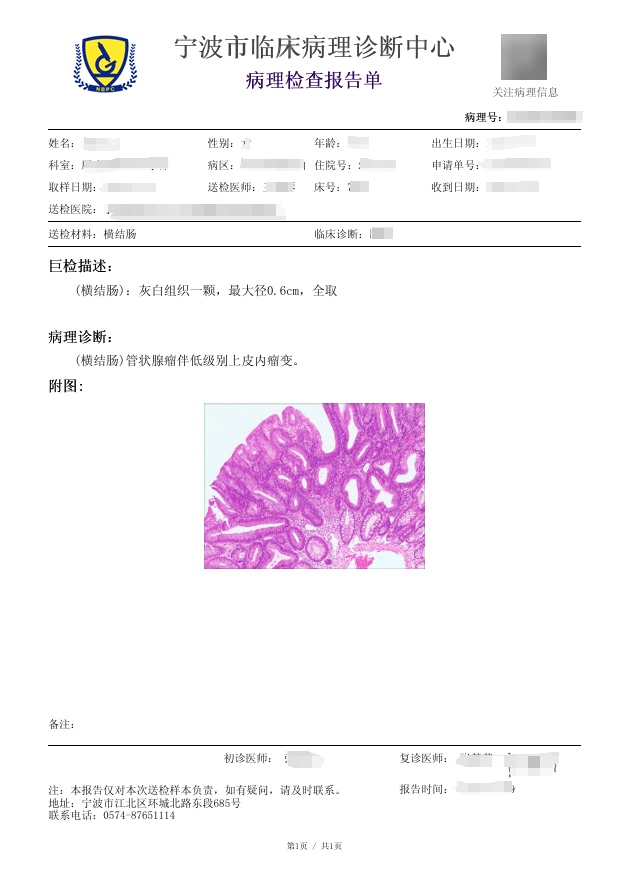 肠镜病理报告中的“上皮内瘤变”，离癌有多远？