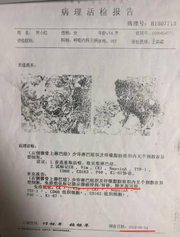 当化疗反应太大，她加上了中药，六年后连医生都感叹！