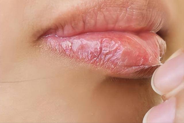 糖尿病人可以常喝这5种饮料，不仅解渴，对血糖还好，帮助控血糖