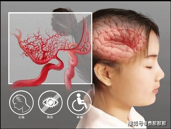 烟雾病患者不及时治疗会有哪些危害