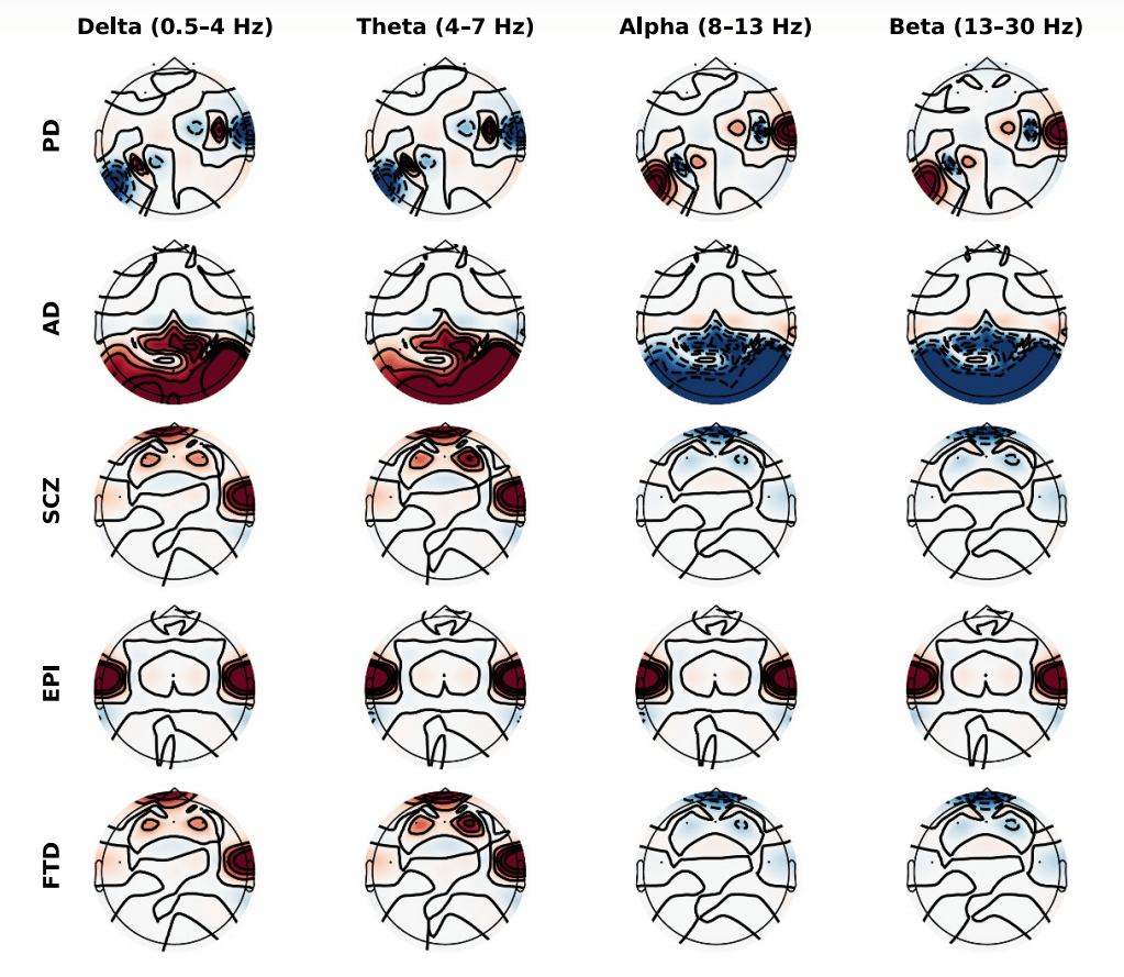 合成疾病脑电图 解决数据集稀缺难题