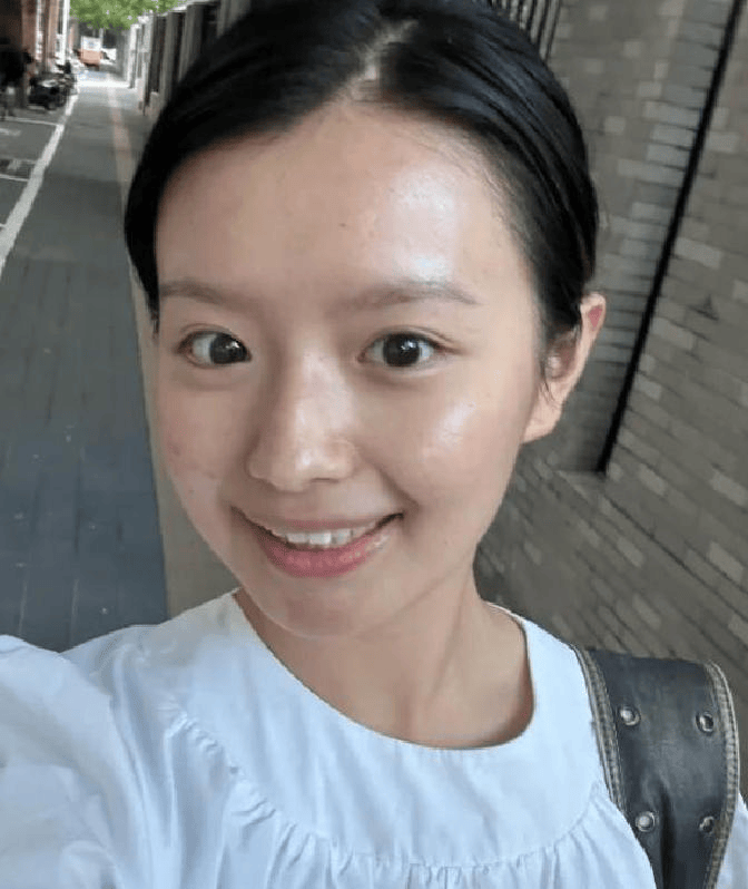 湿疹克星三步走战略告别瘙痒折磨，皮肤重现光滑