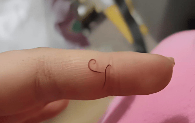 冬天也需防钩虫，这些误区别踩坑！