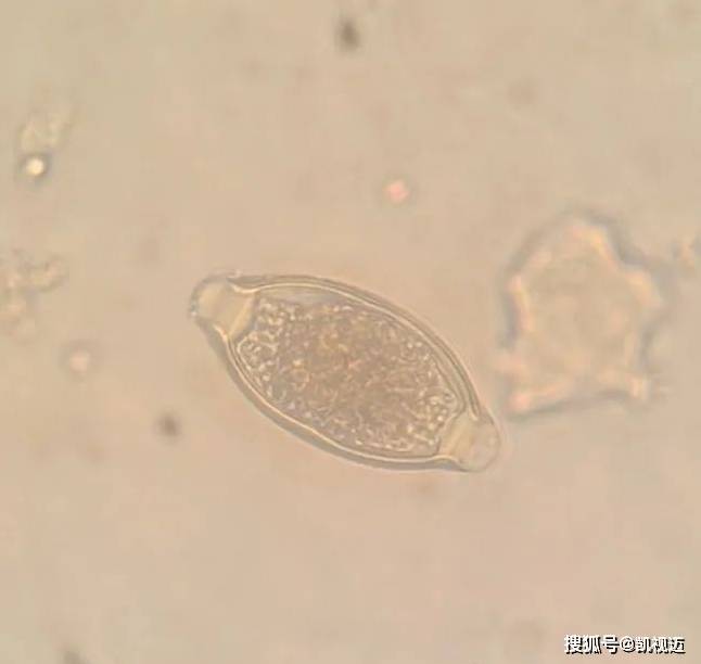 微观世界探秘：显微镜下的寄生虫形态鉴赏