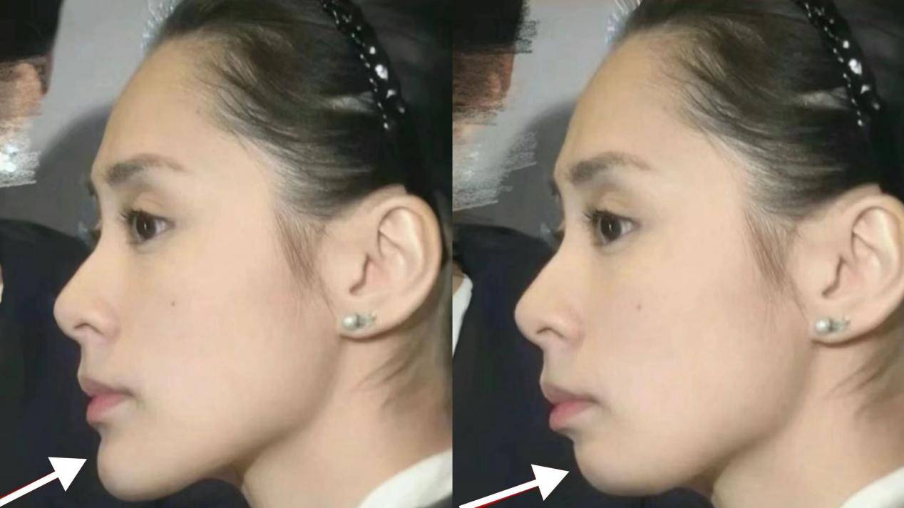 为什么你的下巴一眼“假”？好看又高级的下巴究竟要怎么打？