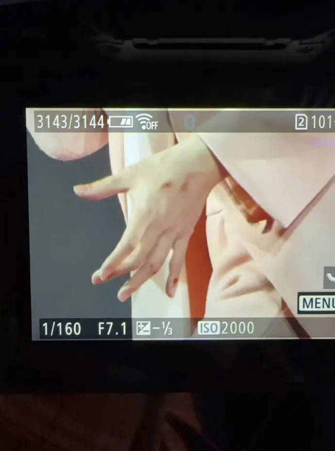 阿信F4演唱会不慎摔下舞台 手指流血仍坚持上台继续演唱