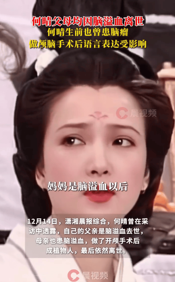 61岁何晴因患脑瘤不治身亡！其父母均因脑溢血离世，曾演《三国演义》小乔