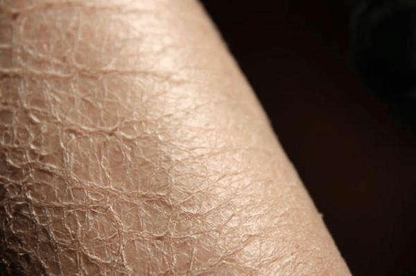 冬季皮肤干痒如砂纸？中医教你从内润到外，养出水润肌