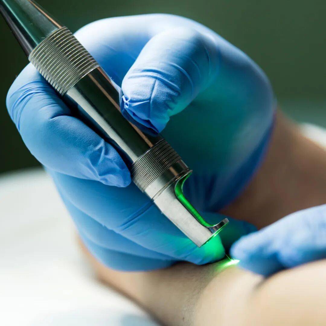 【温馨提示】告别松弛、干涩困扰！CO₂激光阴道无创方案，帮你轻松焕新