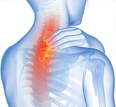 成年人的脊柱侧弯，不痛就不用管？