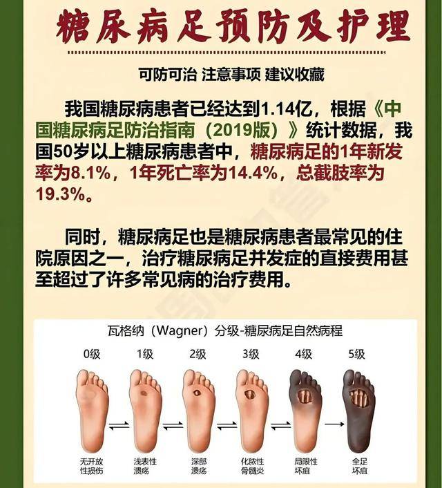糖尿病友脚底这4个部位，有一个没感觉，说明已糖足高危了！