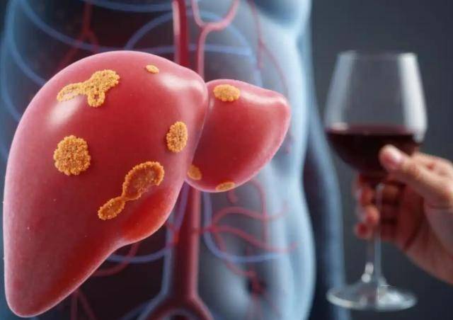 每年200万人因肝病而死，听一句劝：这5件事要少做，肝会感谢你