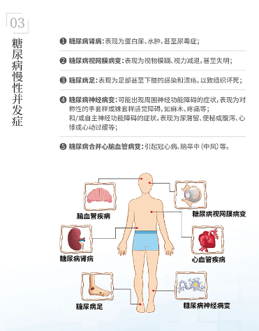糖尿病不止是血糖问题，更需警惕并发症风险