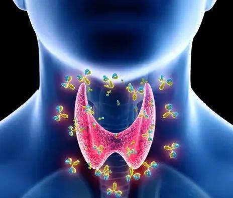 原创            甲状腺报告上“弥漫性病变”是什么意思？需要治疗吗？