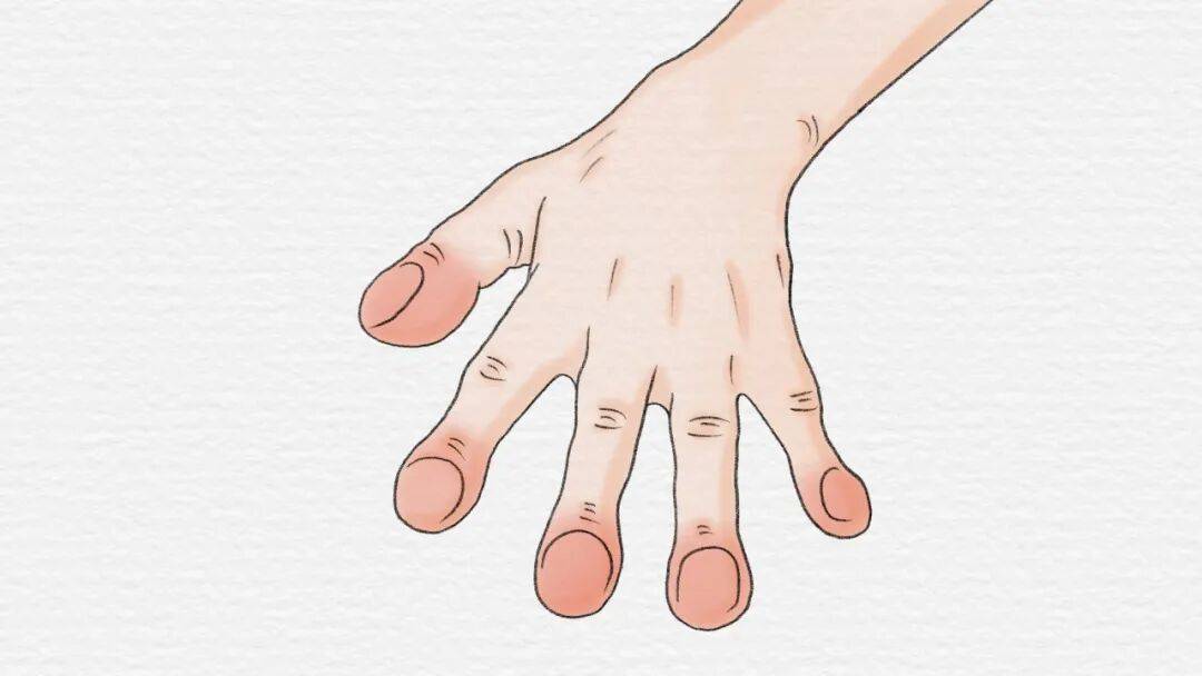 原创            体内有癌、手上先知！手上出现这5个变化，要留心是癌症给的信号