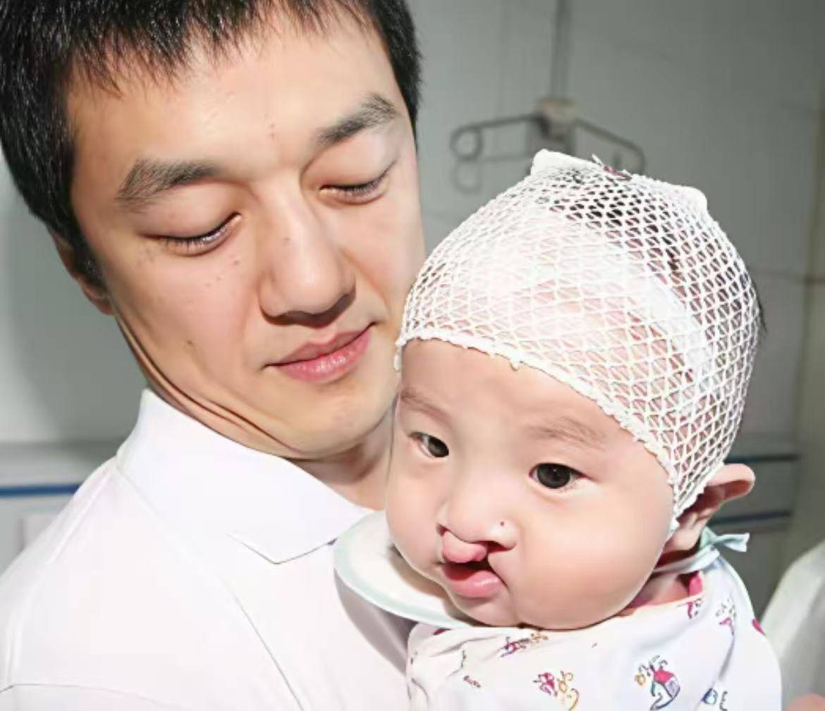 原创            李亚鹏口碑大反转，天使医院坚持唇腭公益，房东被批胃口大