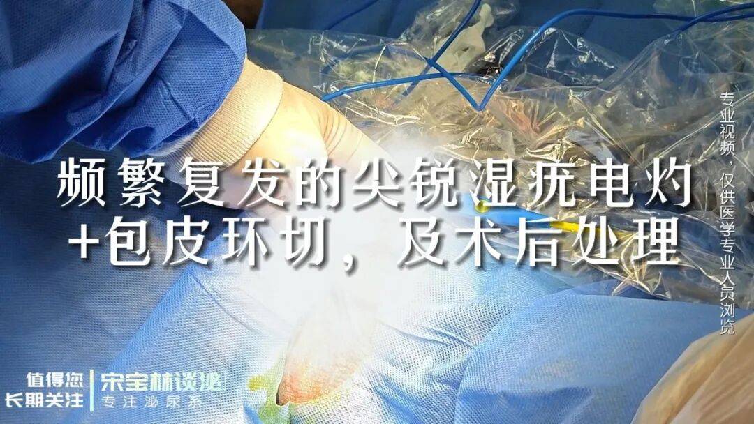 092手术视频｜频繁复发的尖锐湿疣电灼+包皮环切，及术后处理