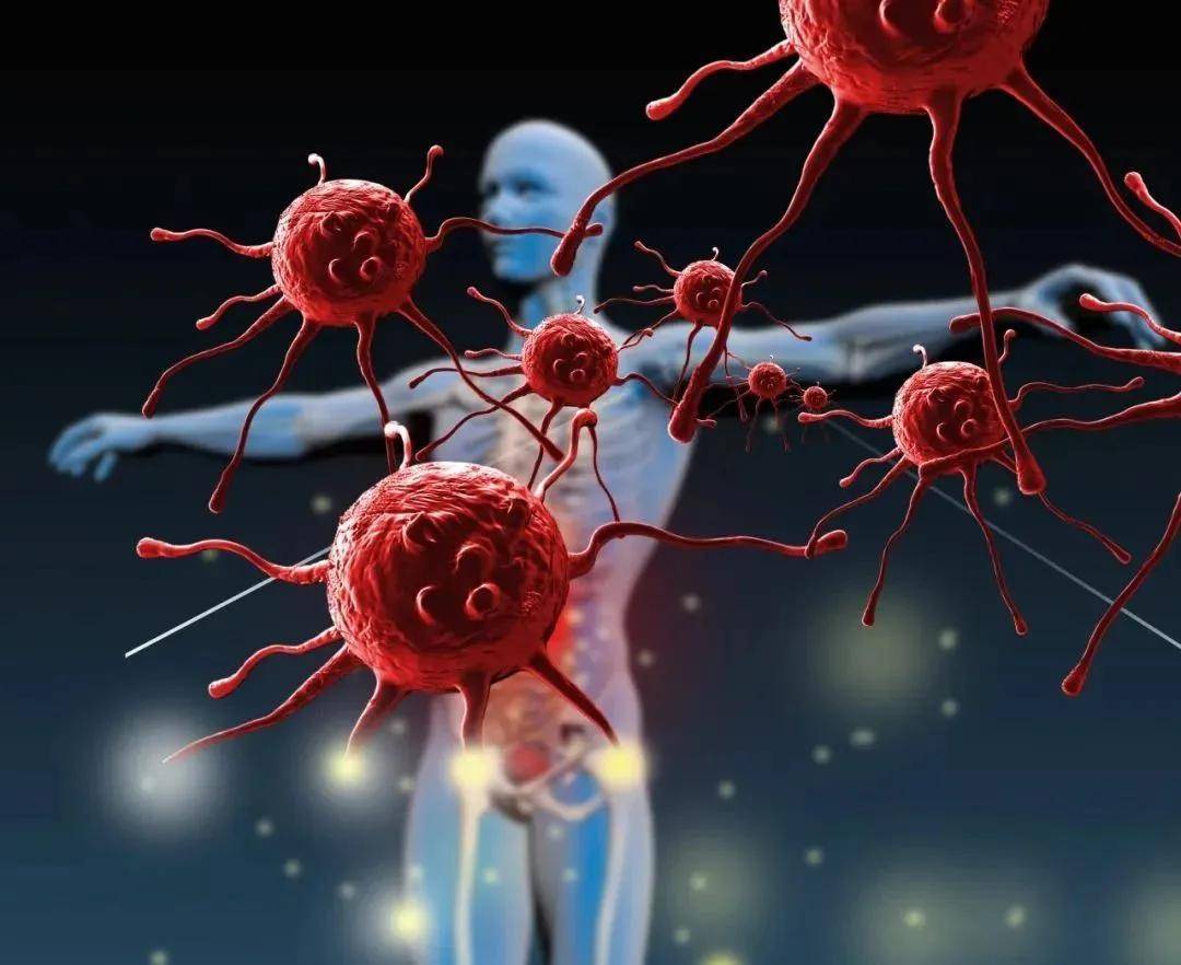 为什么中青年人患癌症的越来越多？应该怎样防范？