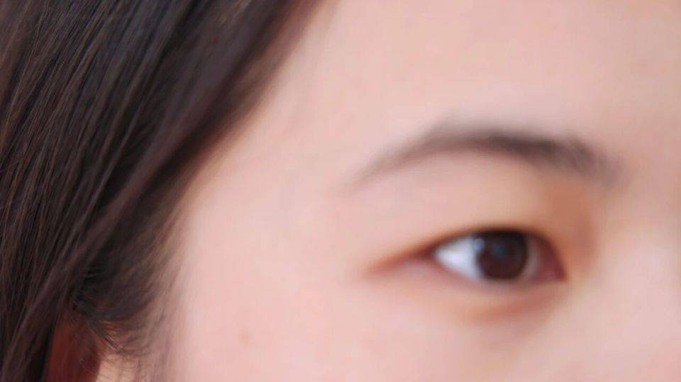 原创            “体内有癌，眼睛先知”，如果眼睛有这5个异常，当心身体患癌了