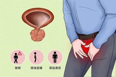 邯郸燕赵刘主任科普生殖感染丨男性常见的生殖感染有哪些？