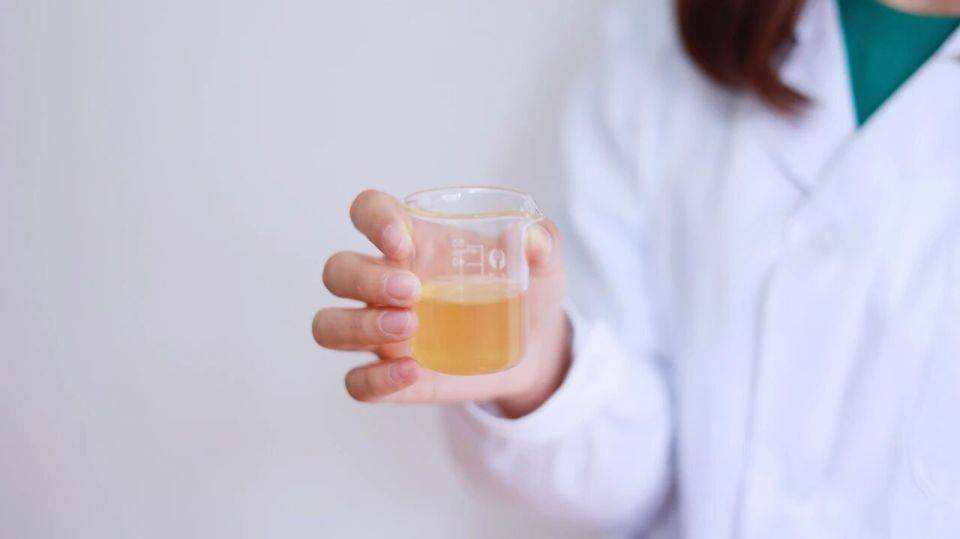 原创            上厕所的时候出现3种异常，别大意，多半是体内尿酸超标给的提示