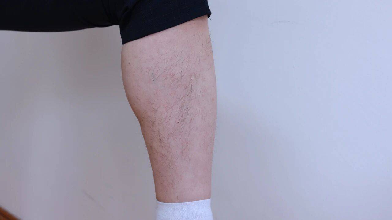 双腿经常出现这4个异常，或是肺部受损给的提示，及时排查是关键