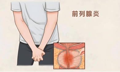 奉劝男性：若不想被前列腺炎折磨下半生，尽早改掉这 4 大习惯！