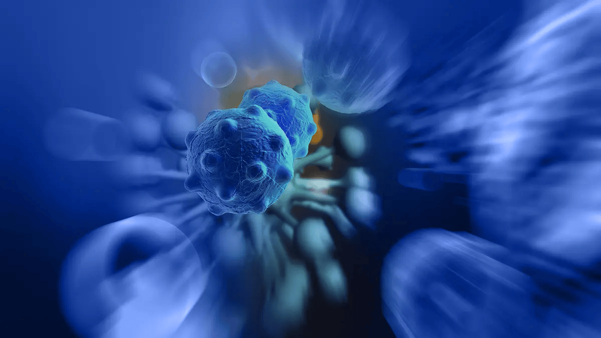 肝癌治疗中，比肿瘤更磨人的是无休止腹泻!46岁男子的求医转折