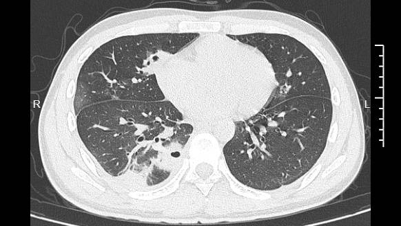 演员关凌发文：血泪教训，我对不起我的好大儿！