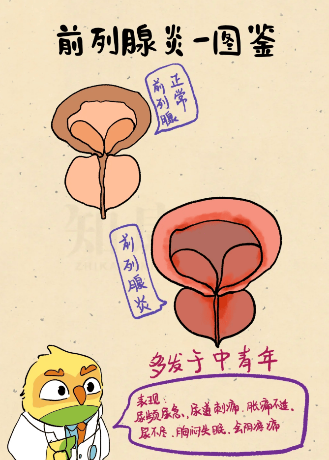 中年男性精力差、前列腺困扰咋解决？联合调理引争议！效果真假待辨