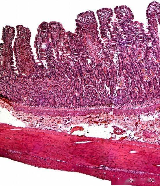 3类胃黏膜保护剂精准搭配！修复胃黏膜护肠胃，远离胃部病变