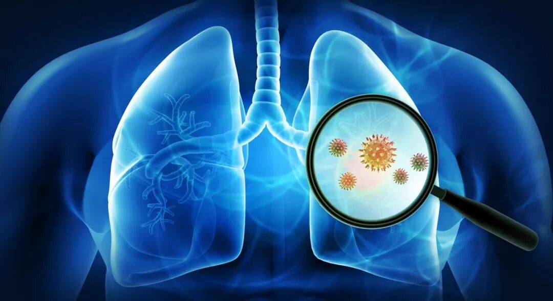 这个不起眼的信号，可能是肺癌扩散前的最后警报！很多人还以为是感冒