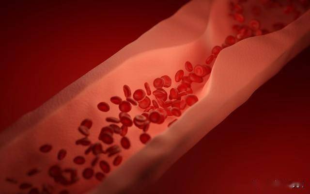 3款经典抗栓溶栓中成药，一文读懂！辨证用对，守护心脑血管健康